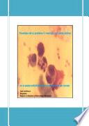 Fenotipia de la Proteína C Reactiva y el Ácido Siálico en la postprandialidad y en la malnutrición por exceso